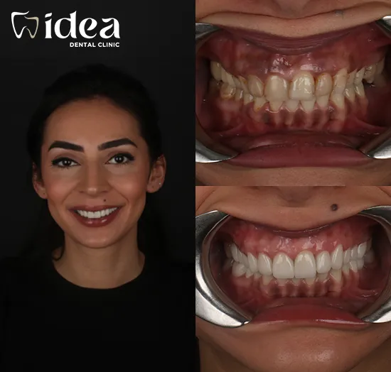 Before & After 1