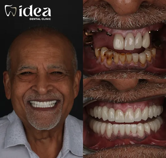 Before & After 9