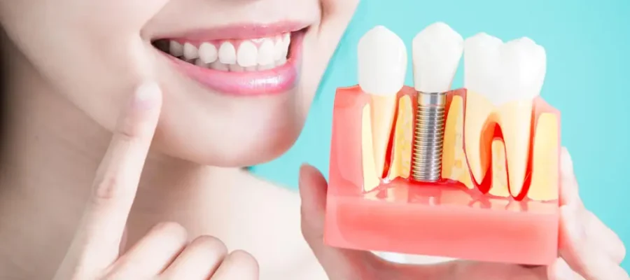 Dental Crowns in Turkey