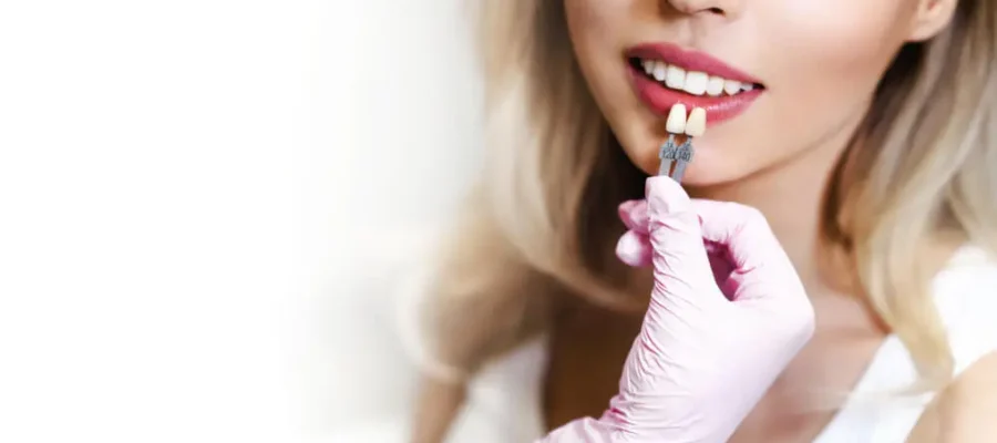 why veneers in turkey 900x